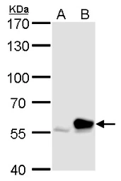 Anti-Rhotekin antibody used in Western Blot (WB). GTX114161
