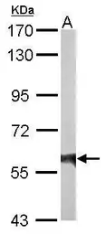 Anti-Rhotekin antibody used in Western Blot (WB). GTX114161