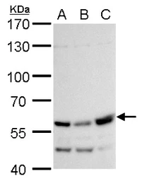 Anti-Rhotekin antibody used in Western Blot (WB). GTX114161