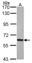 Anti-Rhotekin antibody used in Western Blot (WB). GTX114161