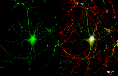 Anti-Renin Receptor antibody [N3C3] used in Immunocytochemistry/ Immunofluorescence (ICC/IF). GTX114169