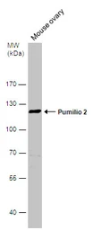Anti-Pumilio 2 antibody [C2C3], C-term used in Western Blot (WB). GTX114172