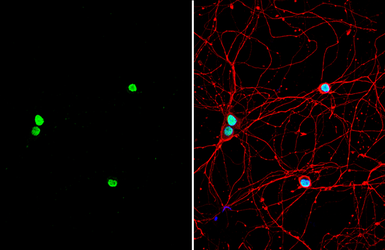 Anti-Pumilio 2 antibody [C2C3], C-term used in Immunocytochemistry/ Immunofluorescence (ICC/IF). GTX114172