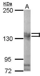 Anti-Pumilio 2 antibody [C2C3], C-term used in Western Blot (WB). GTX114172