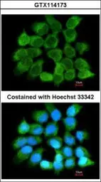 Anti-NNT1 antibody used in Immunocytochemistry/ Immunofluorescence (ICC/IF). GTX114173