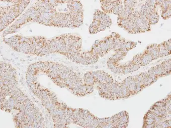 Anti-NNT1 antibody used in IHC (Paraffin sections) (IHC-P). GTX114173