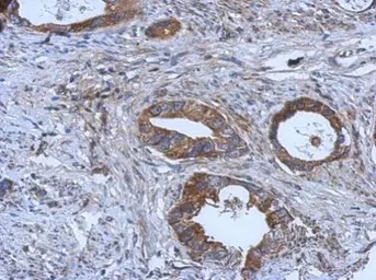 Anti-GGA1 antibody used in IHC (Paraffin sections) (IHC-P). GTX114175