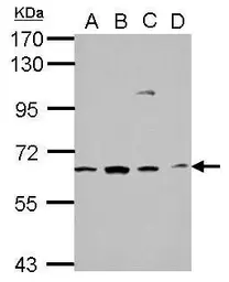 Anti-GGA1 antibody used in Western Blot (WB). GTX114175