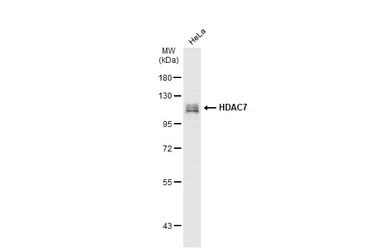 Anti-HDAC7 antibody [C2C3], C-term used in Western Blot (WB). GTX114179