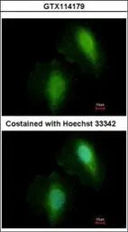 Anti-HDAC7 antibody [C2C3], C-term used in Immunocytochemistry/ Immunofluorescence (ICC/IF). GTX114179