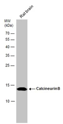 Anti-Calcineurin B antibody used in Western Blot (WB). GTX114181