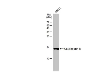 Anti-Calcineurin B antibody used in Western Blot (WB). GTX114181