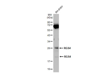 Anti-RGS4 antibody used in Western Blot (WB). GTX114184