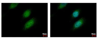 Anti-UBE2A antibody used in Immunocytochemistry/ Immunofluorescence (ICC/IF). GTX114186