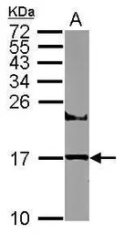 Anti-UBE2A antibody used in Western Blot (WB). GTX114186