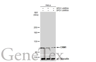 Anti-CRM1 antibody used in Western Blot (WB). GTX114188
