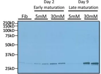 Anti-GADD153 antibody [9C8] used in Western Blot (WB). GTX11419