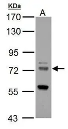 Anti-ZDHHC17 antibody used in Western Blot (WB). GTX114192