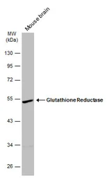 Anti-Glutathione Reductase antibody [N2C2], Internal used in Western Blot (WB). GTX114199