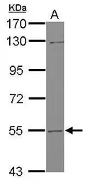 Anti-UGT2B7 antibody used in Western Blot (WB). GTX114203