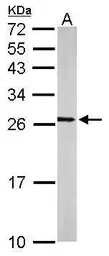 Anti-RALA antibody used in Western Blot (WB). GTX114204