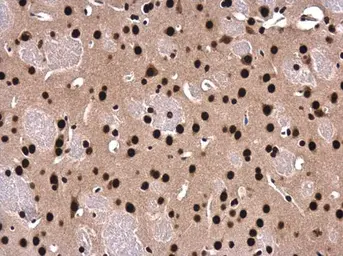 Anti-SFPQ antibody [N2C1], Internal used in IHC (Paraffin sections) (IHC-P). GTX114209