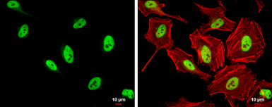 Anti-SFPQ antibody [N2C1], Internal used in Immunocytochemistry/ Immunofluorescence (ICC/IF). GTX114209