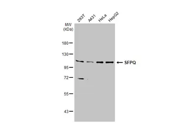 Anti-SFPQ antibody [N2C1], Internal used in Western Blot (WB). GTX114209