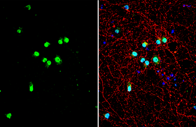 Anti-TDP43 antibody used in Immunocytochemistry/ Immunofluorescence (ICC/IF). GTX114210