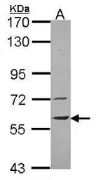 Anti-Vanin 1 antibody [N3C3] used in Western Blot (WB). GTX114212