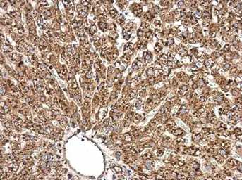 Anti-Radixin antibody [N3C3] used in IHC (Paraffin sections) (IHC-P). GTX114219