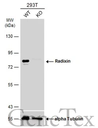 Anti-Radixin antibody [N3C3] used in Western Blot (WB). GTX114219