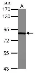 Anti-Radixin antibody [N3C3] used in Western Blot (WB). GTX114219