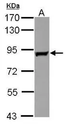 Anti-GAB2 antibody [N1C1] used in Western Blot (WB). GTX114226