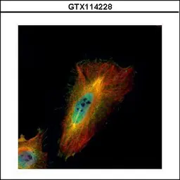 Anti-ABCF1 antibody used in Immunocytochemistry/ Immunofluorescence (ICC/IF). GTX114228