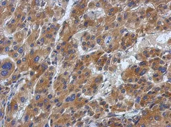 Anti-ABCF1 antibody used in IHC (Paraffin sections) (IHC-P). GTX114228