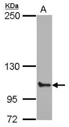 Anti-ABCF1 antibody used in Western Blot (WB). GTX114228