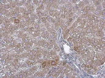Anti-ACAA1 antibody used in IHC (Paraffin sections) (IHC-P). GTX114230
