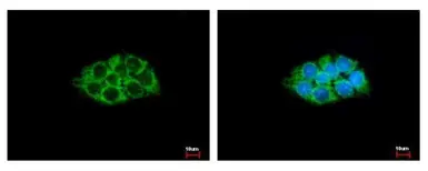 Anti-ACAA1 antibody used in Immunocytochemistry/ Immunofluorescence (ICC/IF). GTX114230