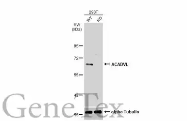 Anti-ACADVL antibody [N1C1] used in Western Blot (WB). GTX114232