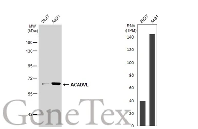 Anti-ACADVL antibody [N1C1] used in Western Blot (WB). GTX114232