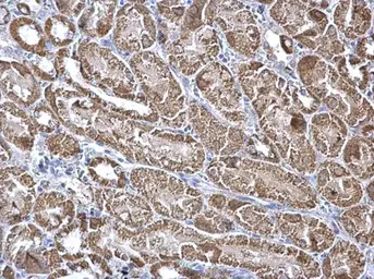 Anti-Aconitase 2 antibody [N1N3] used in IHC (Paraffin sections) (IHC-P). GTX114233