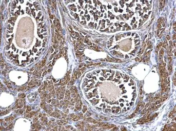 Anti-Aconitase 2 antibody [N1N3] used in IHC (Paraffin sections) (IHC-P). GTX114233