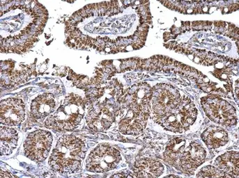 Anti-Aconitase 2 antibody [N1N3] used in IHC (Paraffin sections) (IHC-P). GTX114233