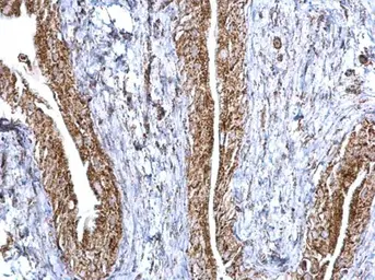 Anti-Aconitase 2 antibody [N1N3] used in IHC (Paraffin sections) (IHC-P). GTX114233