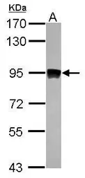Anti-Aconitase 2 antibody [N1N3] used in Western Blot (WB). GTX114233