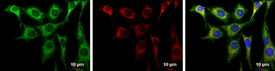 Anti-Aconitase 2 antibody [N1N3] used in Immunocytochemistry/ Immunofluorescence (ICC/IF). GTX114233