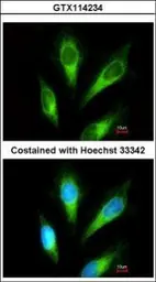 Anti-ACP2 antibody [N2C3] used in Immunocytochemistry/ Immunofluorescence (ICC/IF). GTX114234