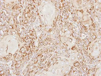 Anti-ACP2 antibody [N2C3] used in IHC (Paraffin sections) (IHC-P). GTX114234