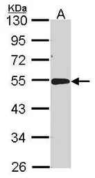 Anti-ACP2 antibody [N2C3] used in Western Blot (WB). GTX114234